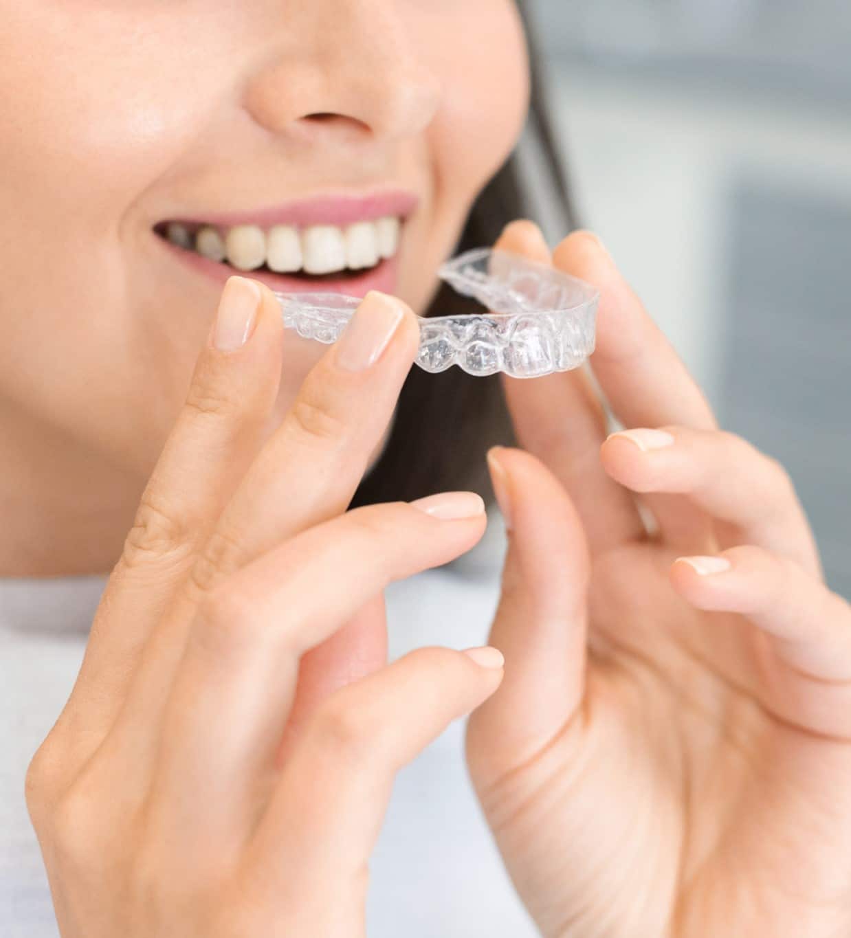 Smile Vegas Dental Adult Braces