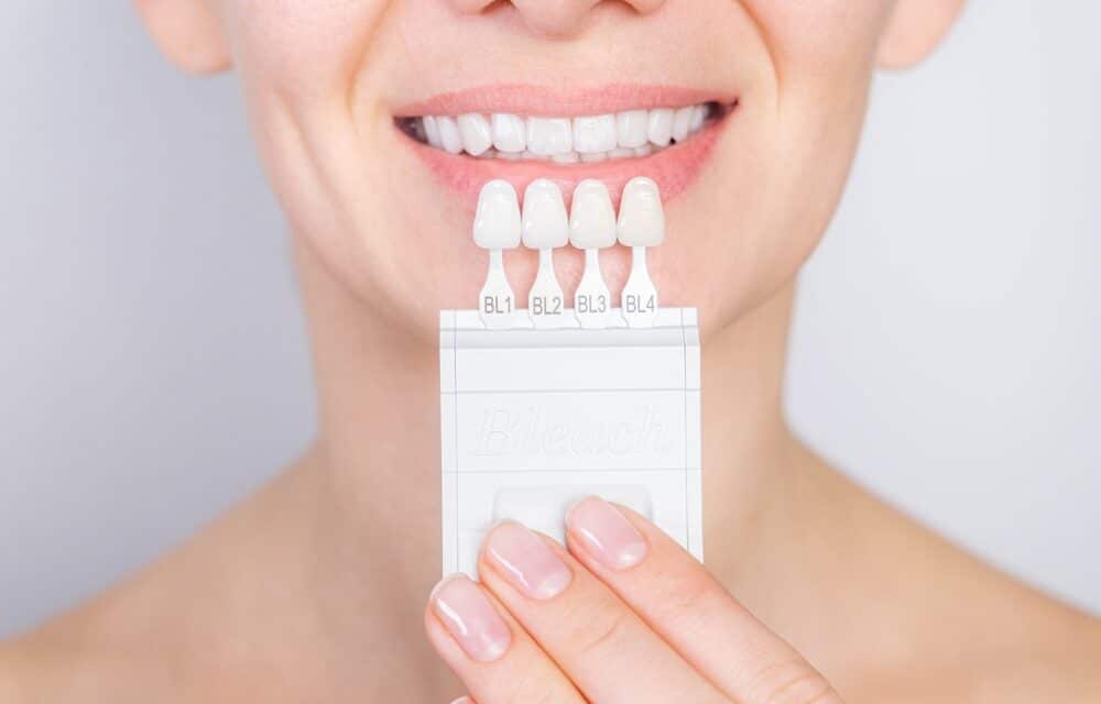 Smile Transformation: Veneers in Las Vegas for a Perfect Look