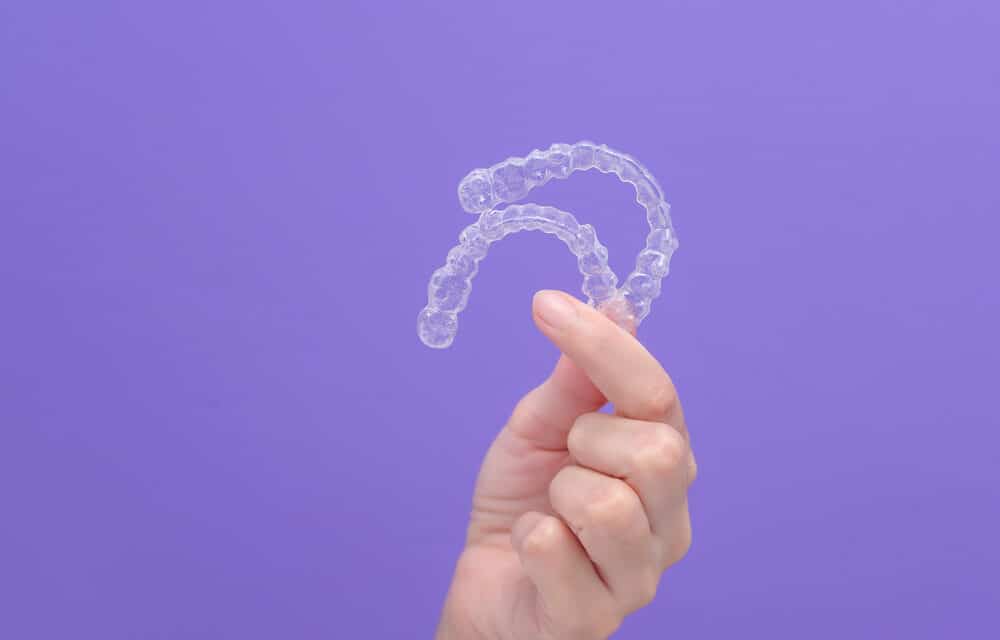 Do I Need to Get Invisalign? The Top 5 Things to Consider