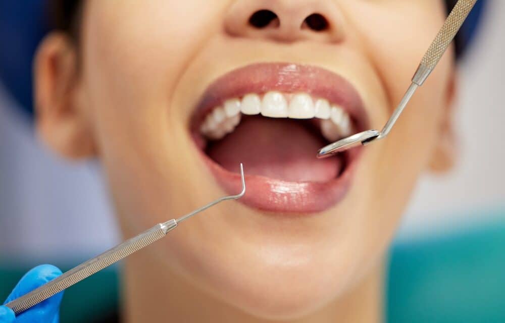 The Impact of Oral Piercings on Your Dental Health