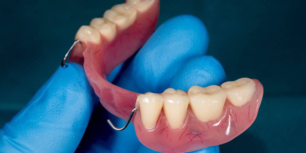 Understanding What aAre Partial Dental Dentures