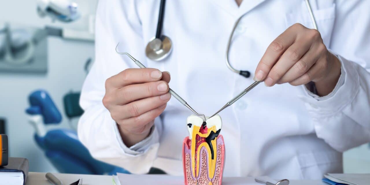 How many root canals can you have? Surprising Facts