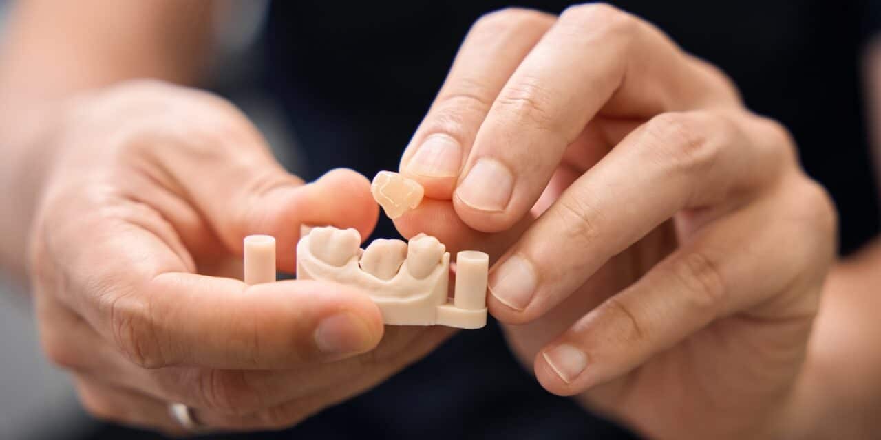 What is a crown for teeth? Transform Your Smiles
